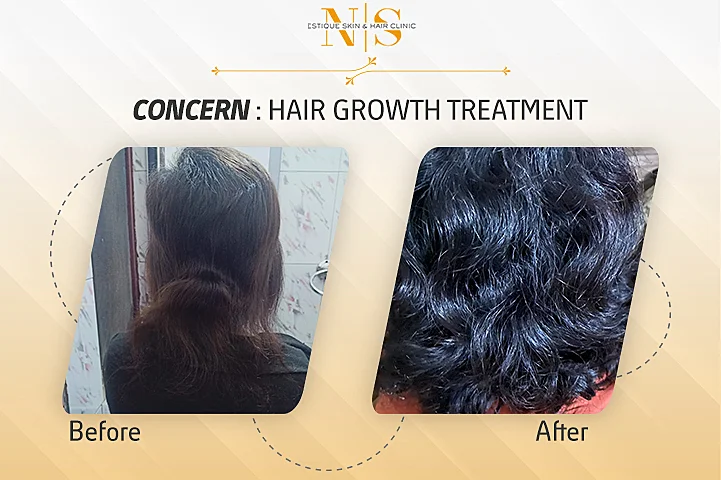 hair restorative