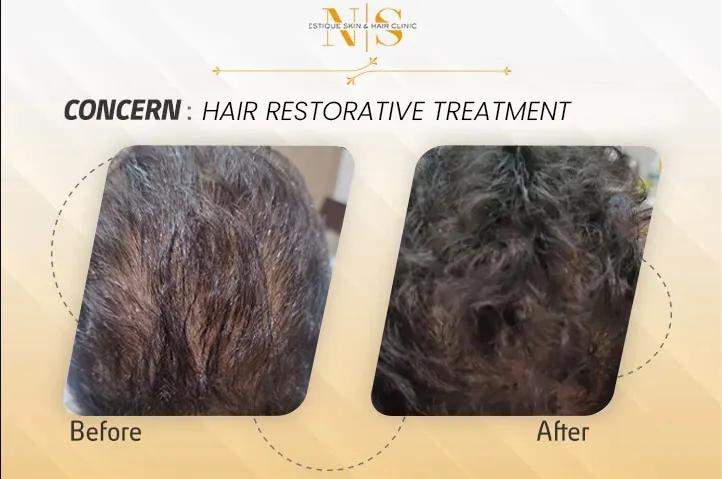 hair restorative