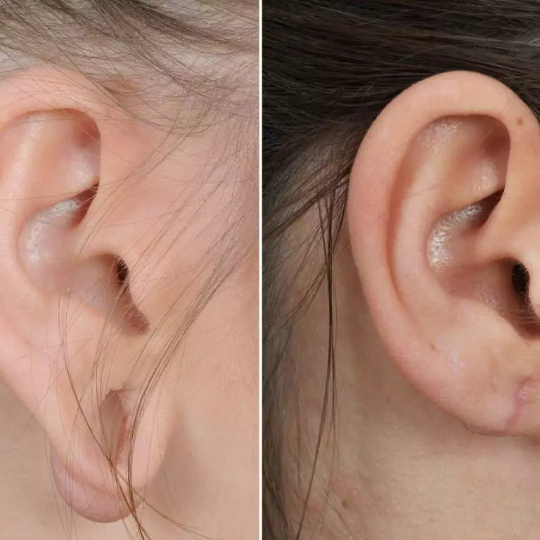 Best Skin Specialist in Gurgaon