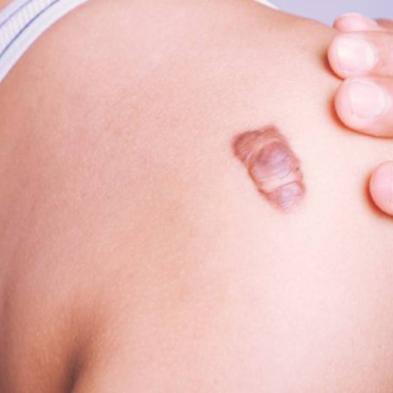 Top Skin Specialist in Gurgaon