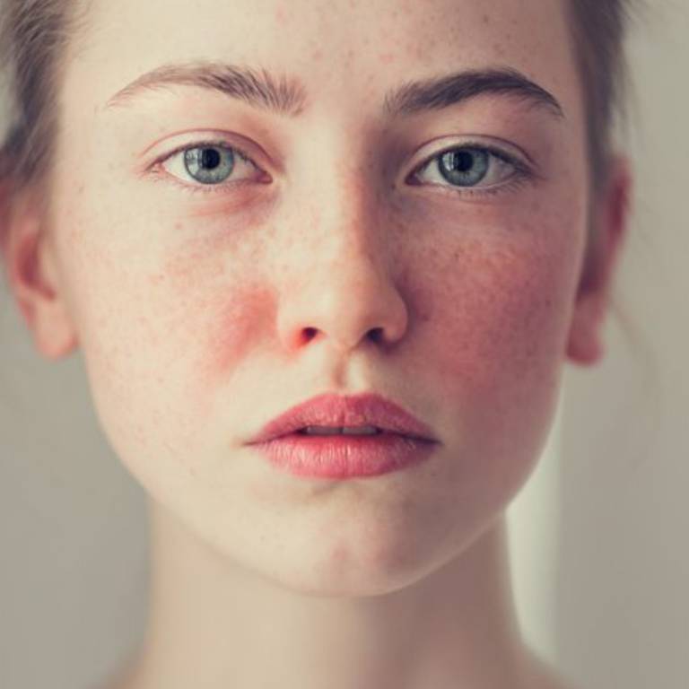 Best Skin Hospital in Gurgaon