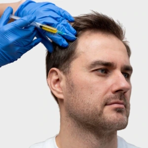 Stem Cell Hair Therapy in Gurgaon