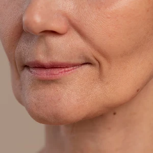 sagging skin treatment in gurgaon