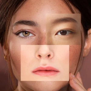 uneven skin tone treatment in gurgaon