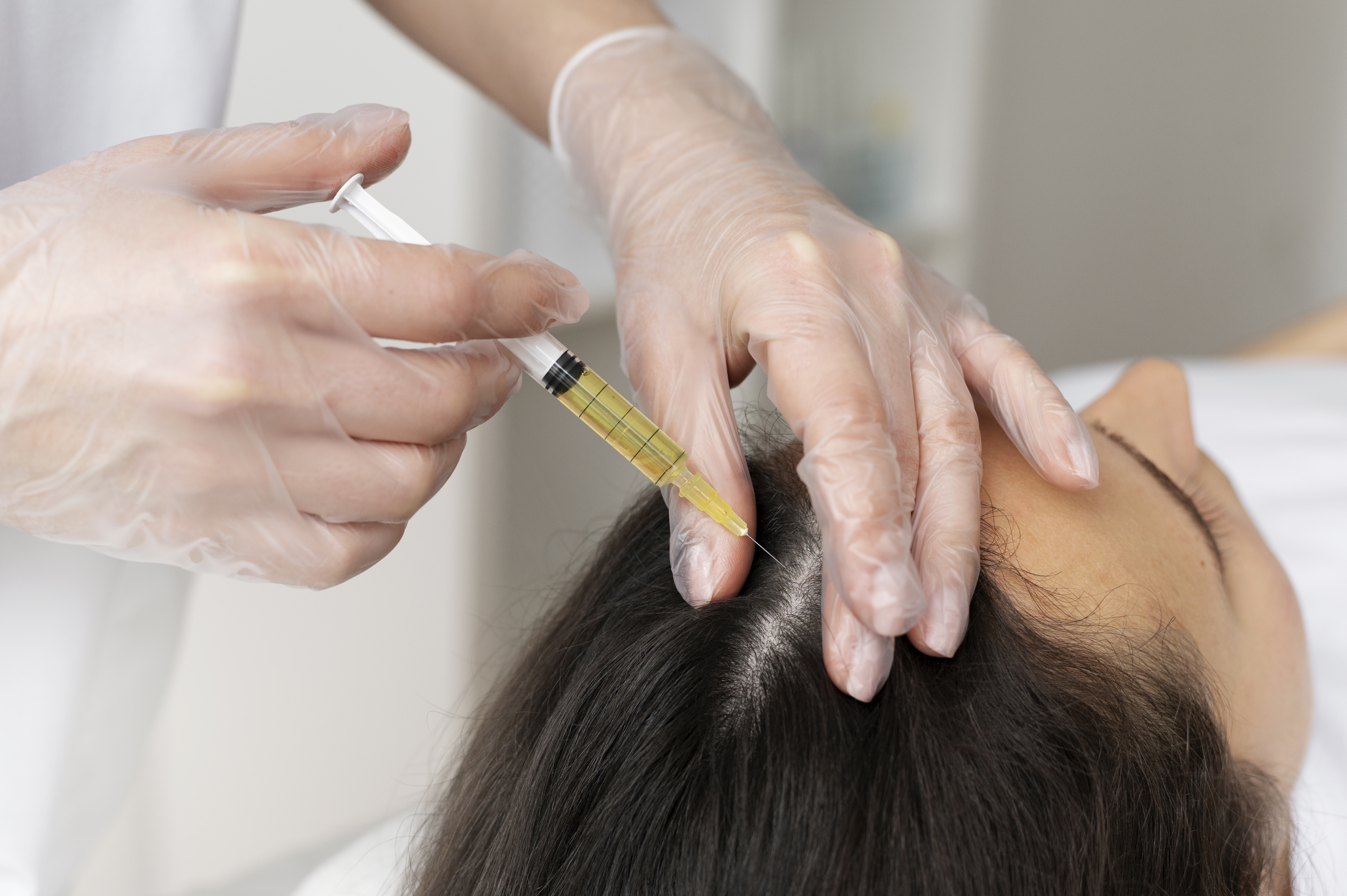 Hair Loss Treatment