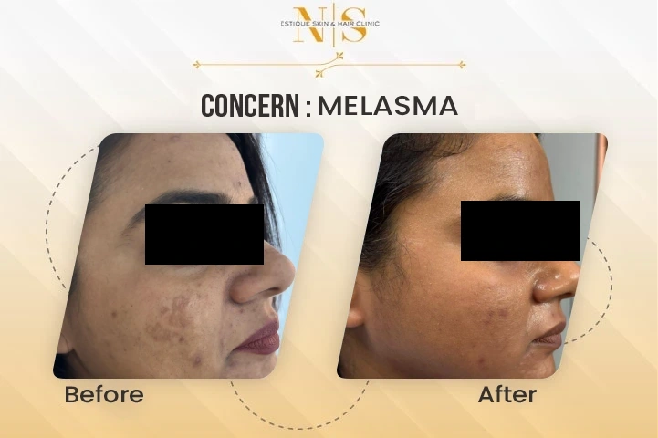 Before and After Result 1