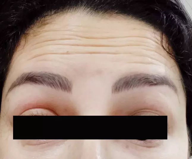 Best Skin Specialist in Gurgaon