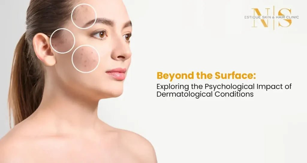 Beyond the Surface: Exploring the Psychological Impact of Dermatological Conditions