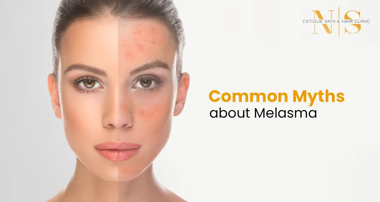 Common Myths about Melasma