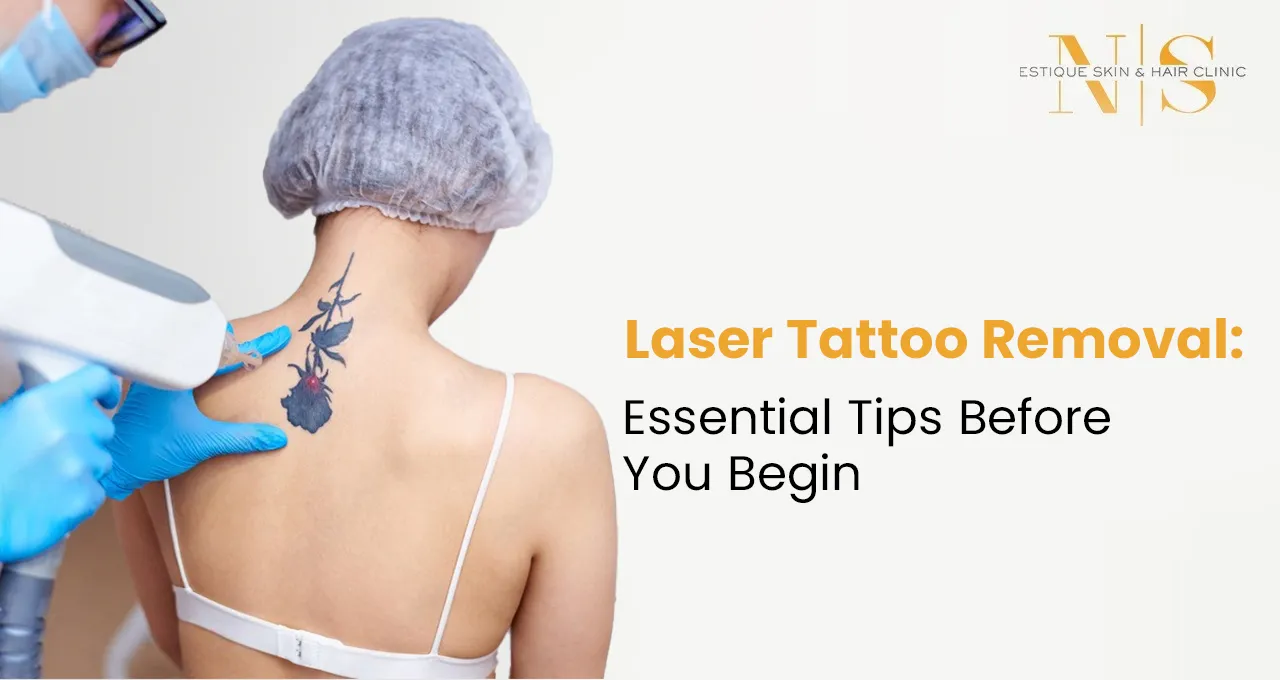 Laser Tattoo Removal: Essential Tips Before You Begin