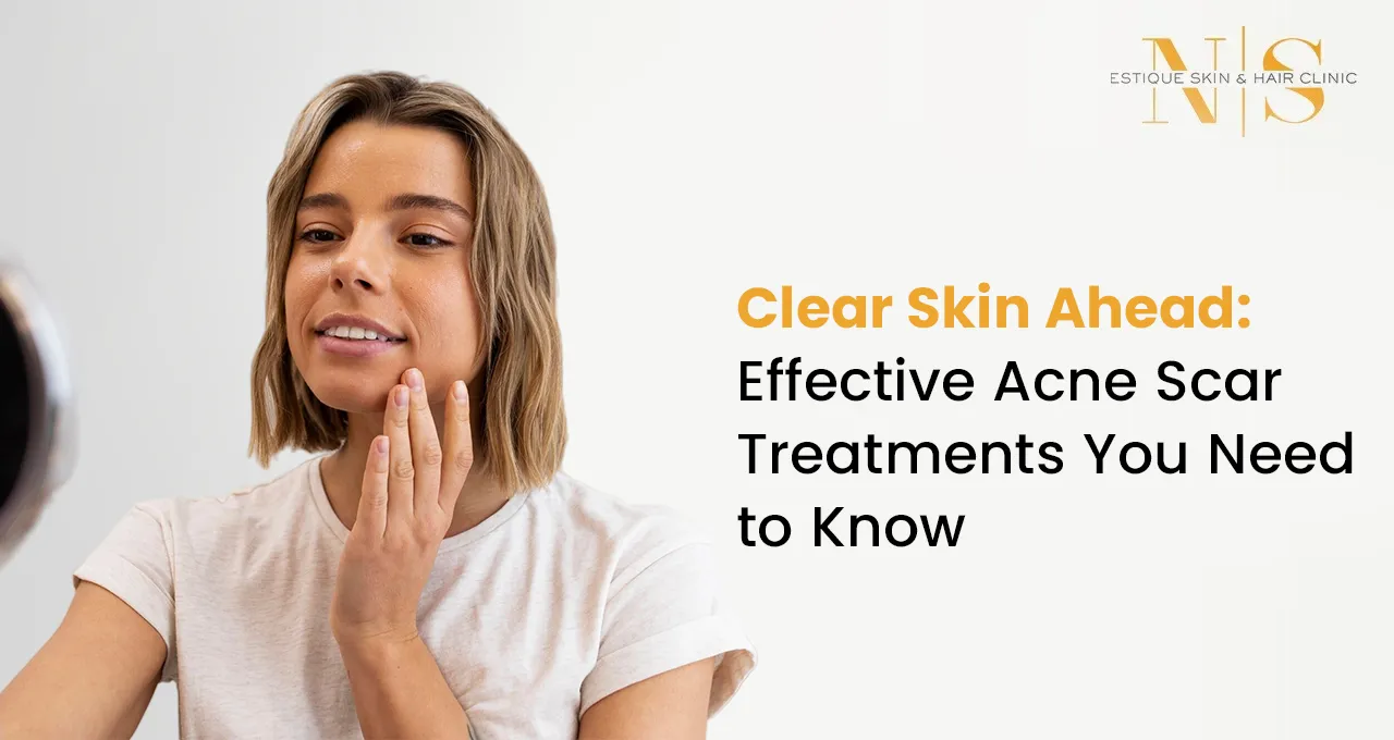 Clear Skin Ahead: Effective Acne Scar Treatments You Need to Know