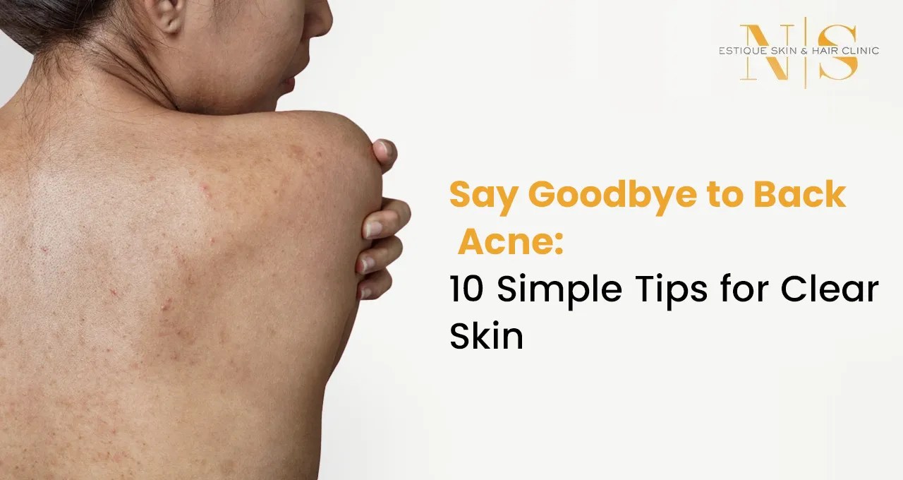 Say Goodbye to Back Acne:10 Simple Tips for Clear Skin