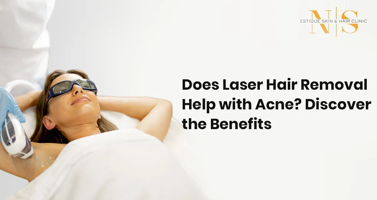 Does Laser Hair Removal Help with Acne? Discover the Benefits