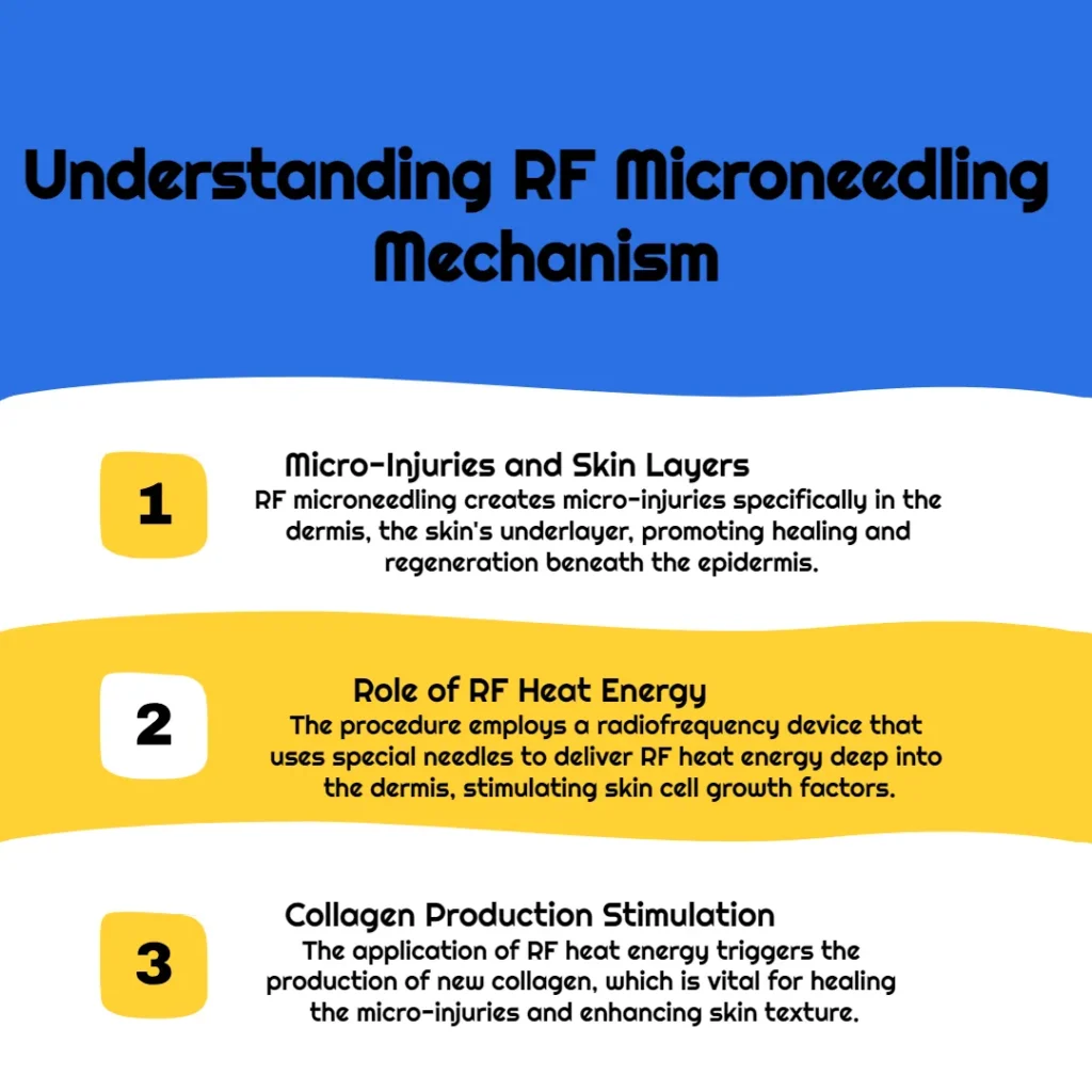 Understanding RF Microneedling Mechanism