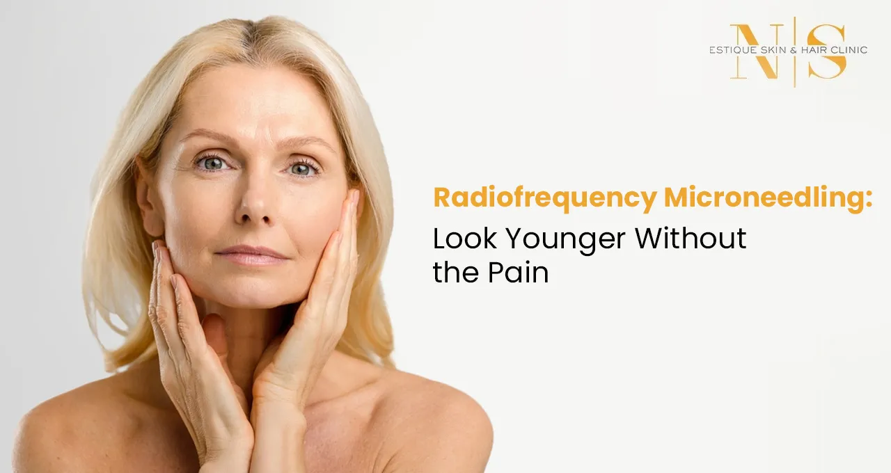 Radiofrequency Microneedling: Look Younger Without the Pain