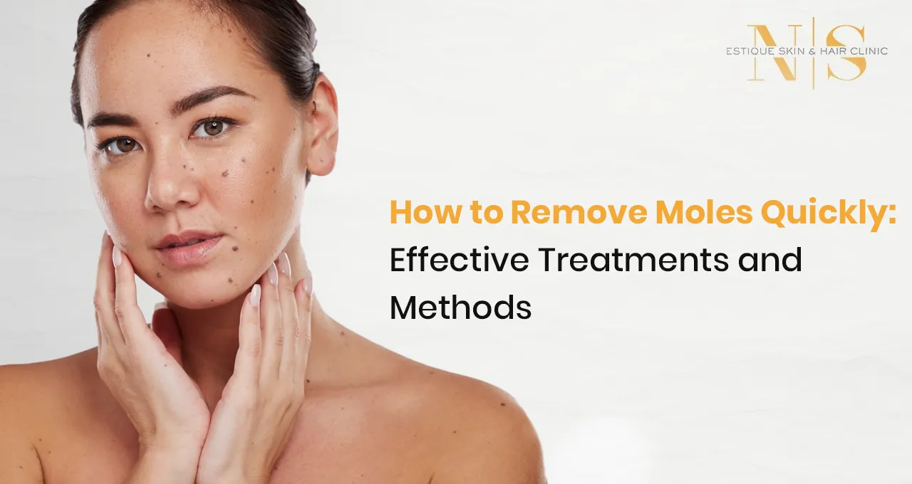 How to Remove Moles Quickly: Effective Treatments and Methods