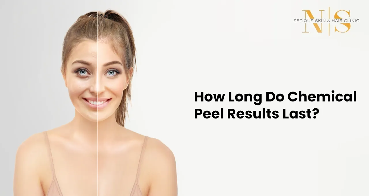 How Long Do Chemical Peel Results Last?