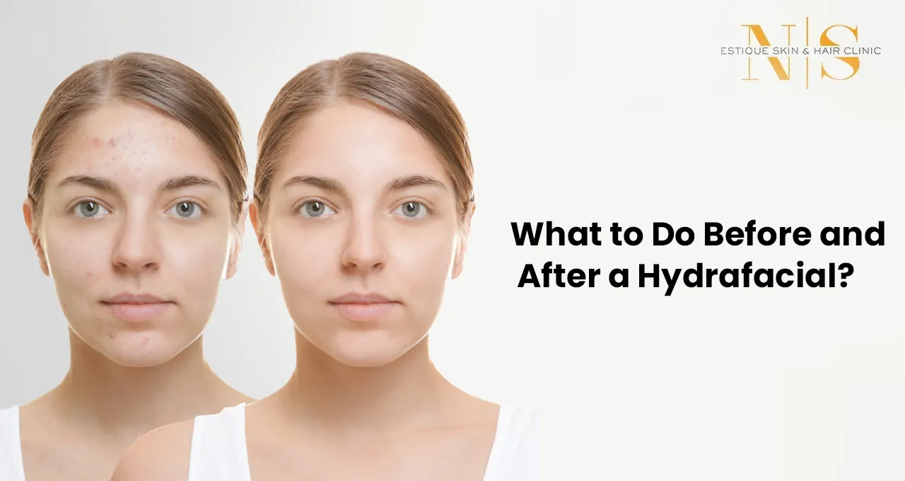 What to Do Before and After a Hydrafacial?