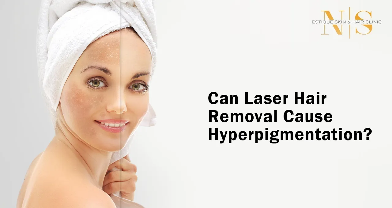 Can Laser Hair Removal Cause Hyperpigmentation?