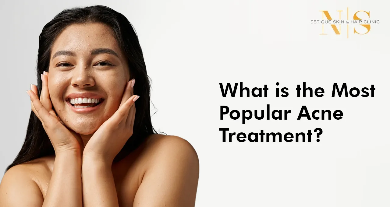 What is the most popular Acne treatment?