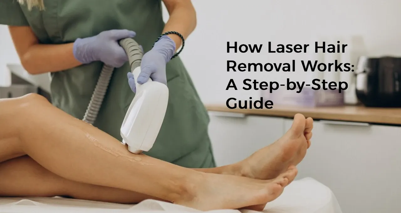 How Laser Hair Removal Works: A Step-by-Step Guide