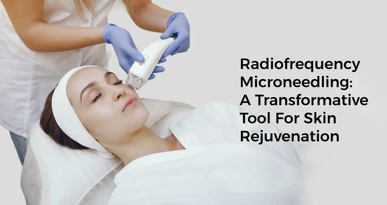 Radiofrequency Microneedling: A Transformative Tool For Skin Rejuvenation