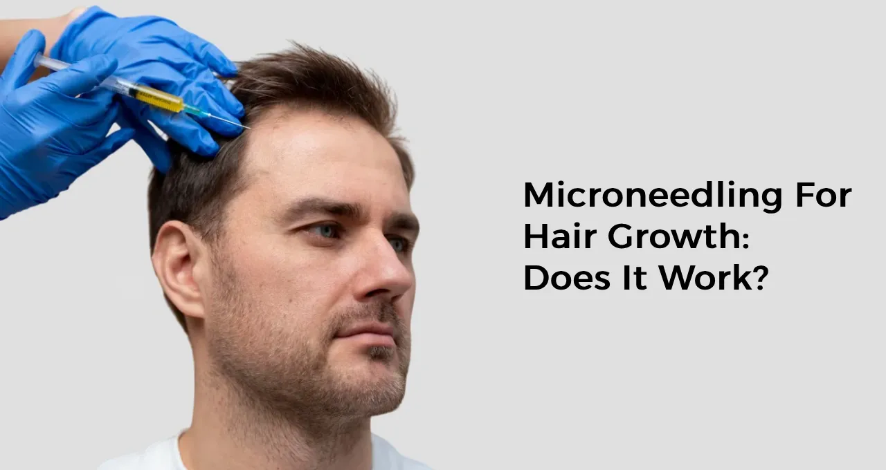 Microneedling For Hair Growth: Does It Work?