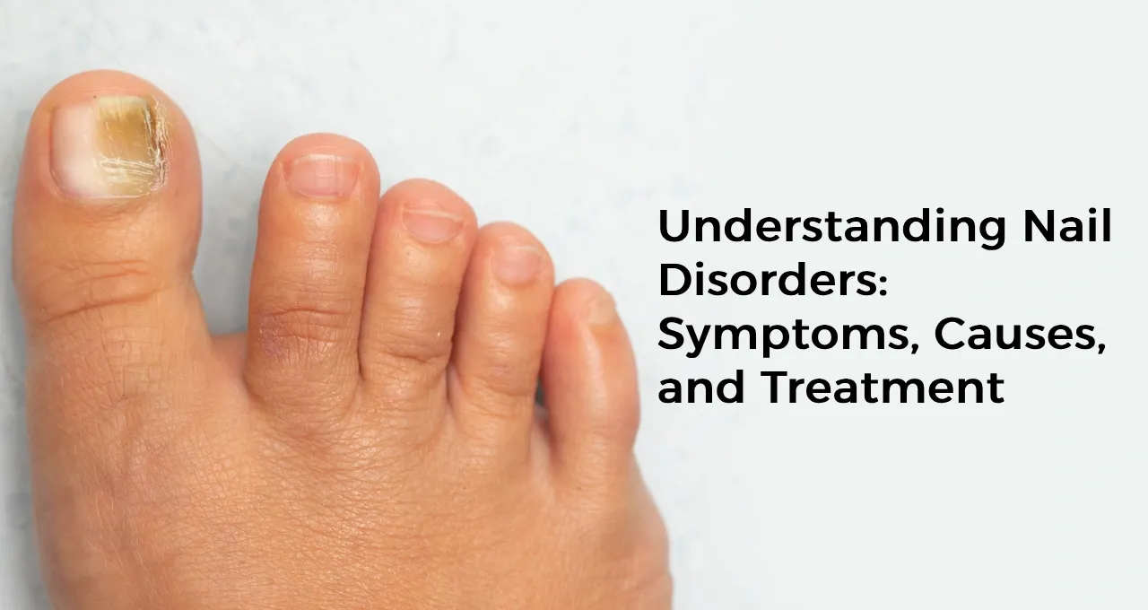 Understanding Nail Disorders: Symptoms, Causes, and Treatment