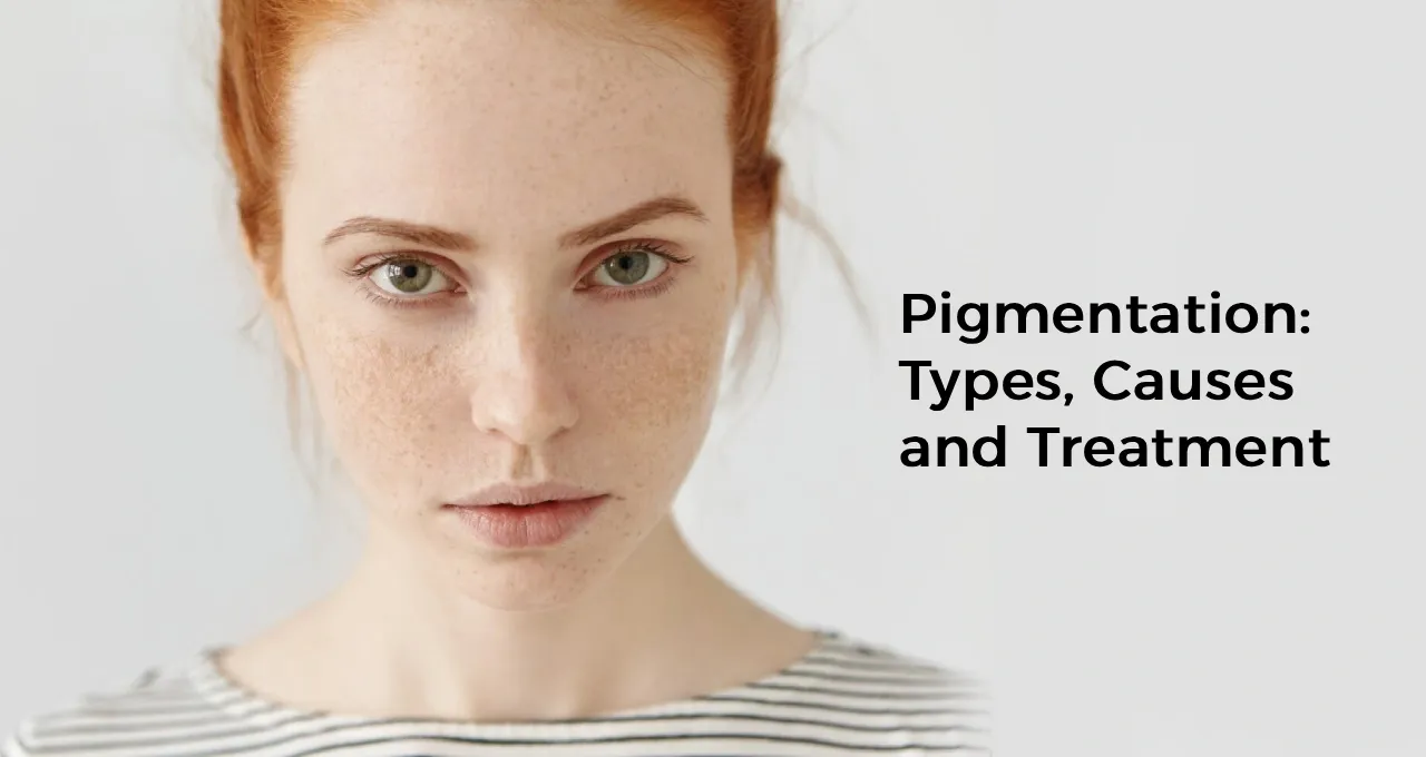 Pigmentation: Types, Causes and Treatment