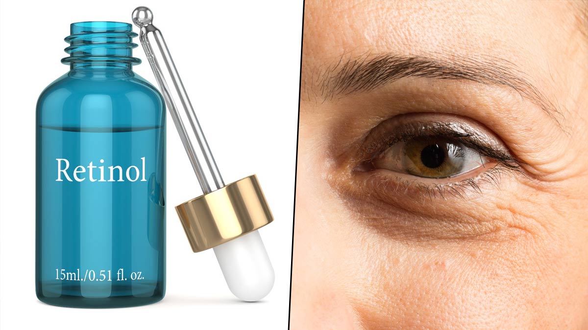 retinoids-reduce-wrinkles