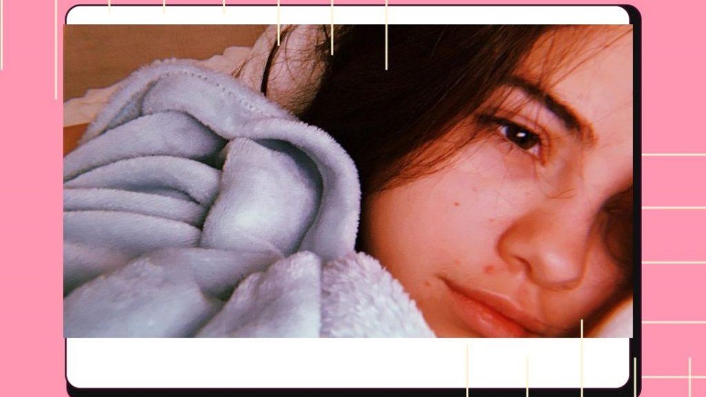 worst skincare stories ever