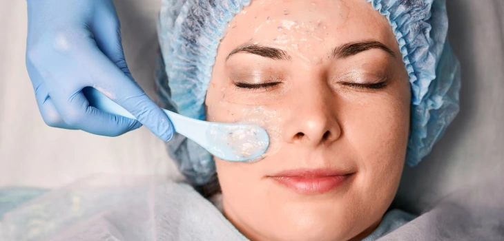 Chemical Peel Treatment in Gurgaon