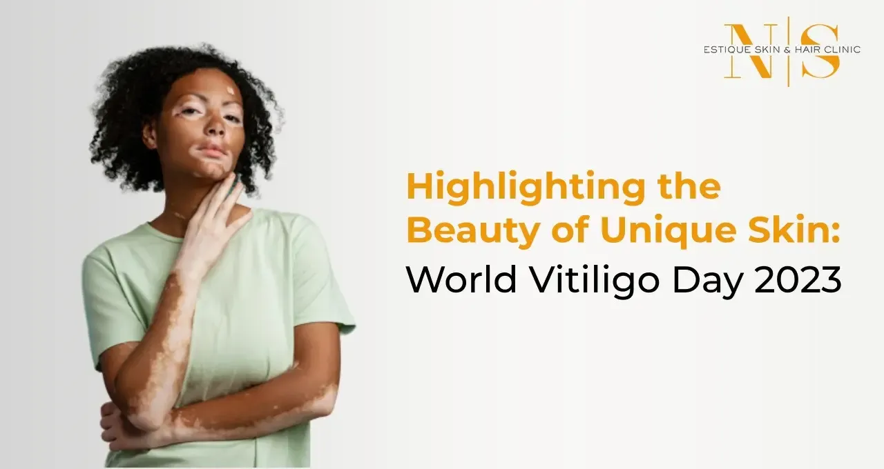 Highlighting the Beauty of Unique Skin: World Vitiligo Day 2023