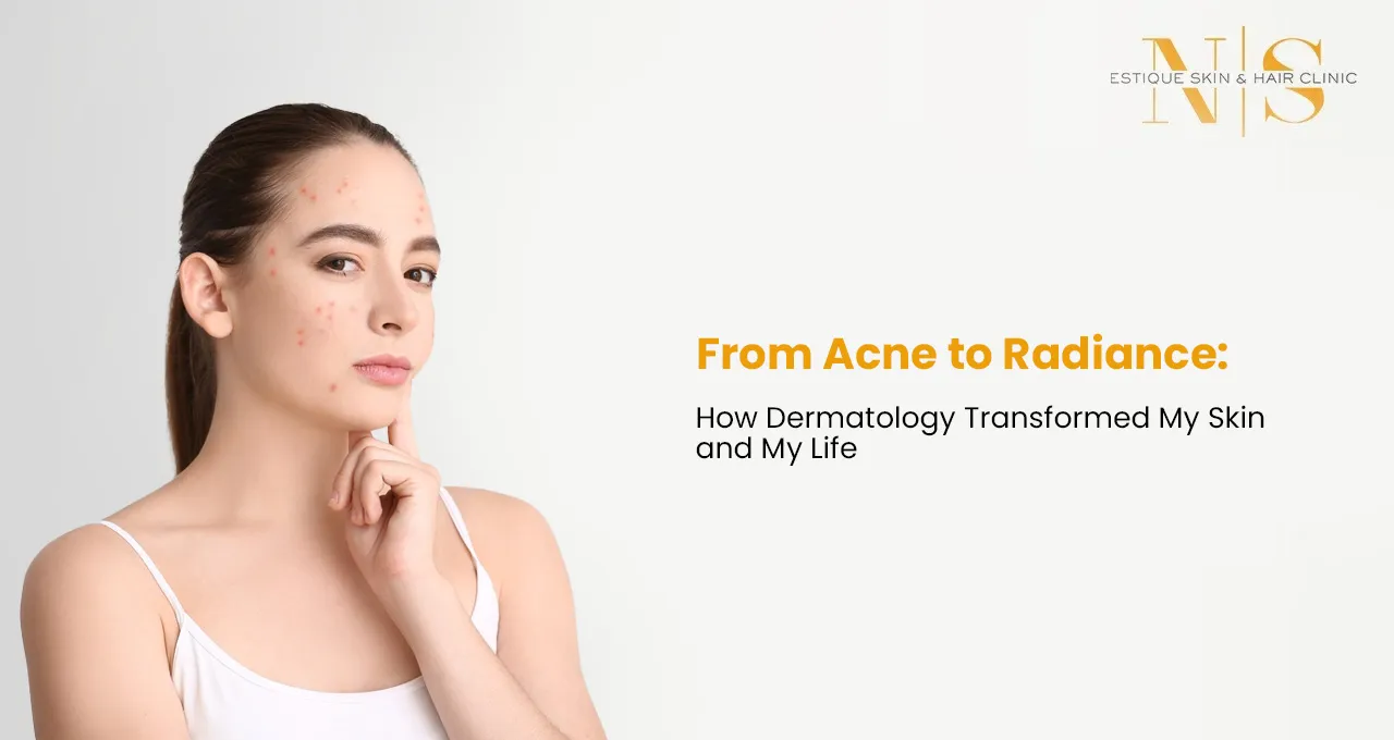 From Acne to Radiance: How Dermatology Transformed My Skin and My Life