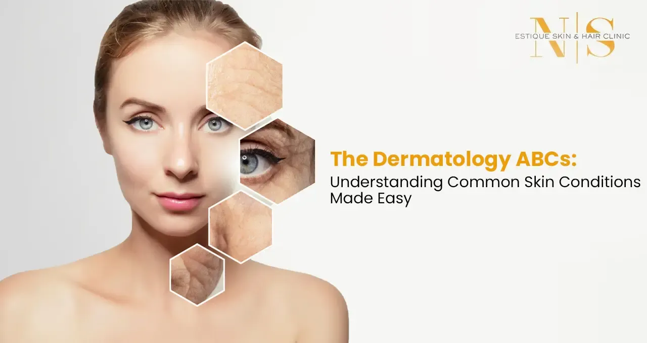 The Dermatology Abcs: Understanding Common Skin Conditions Made Easy