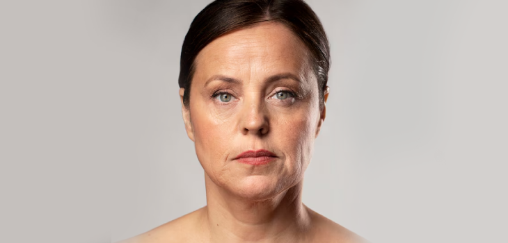 Anti Wrinkle Injections