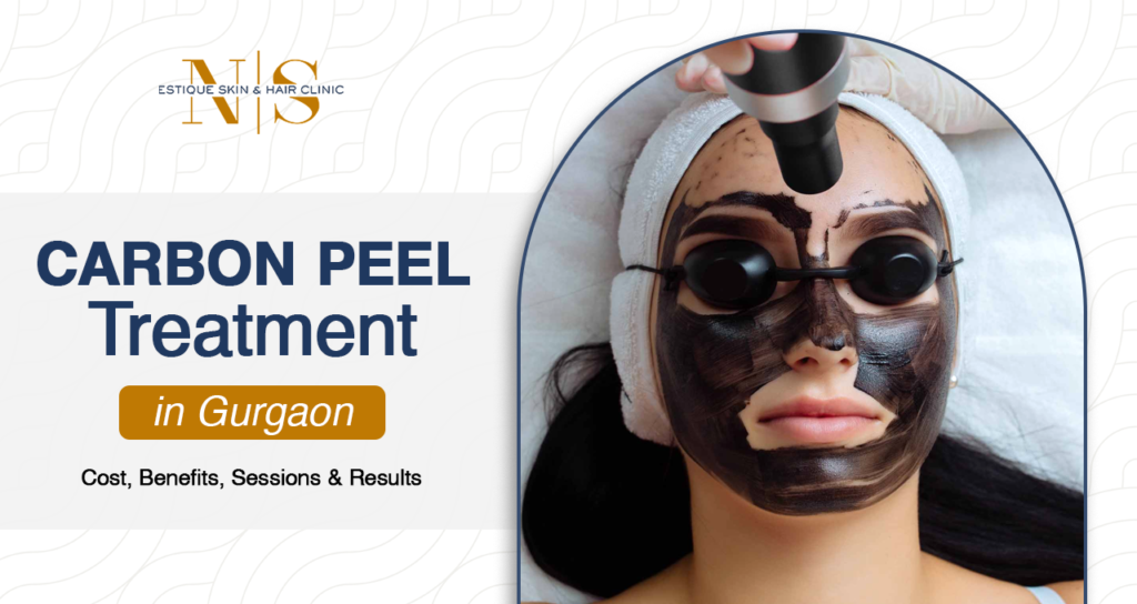 Carbon Peel Treatment in Gurgaon: Cost, Benefits, Sessions & Results.