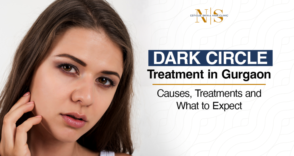Dark Circle Treatment in Gurgaon: Causes, Treatments and What to Expect